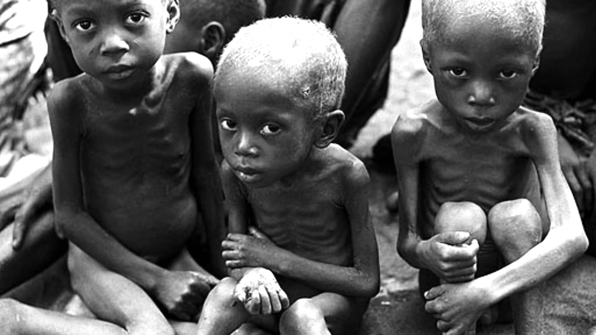 Hunger Problem In Africa 20